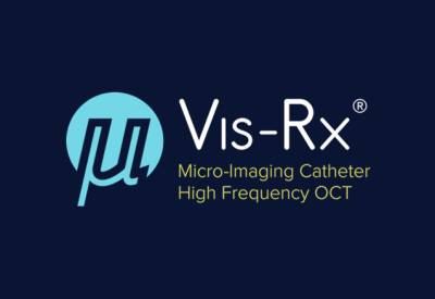 Gentuity HF-OCT System FDA Cleared for Pre- and Post-PCI Imaging